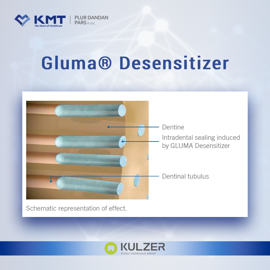 gluma desensitizer chart 1