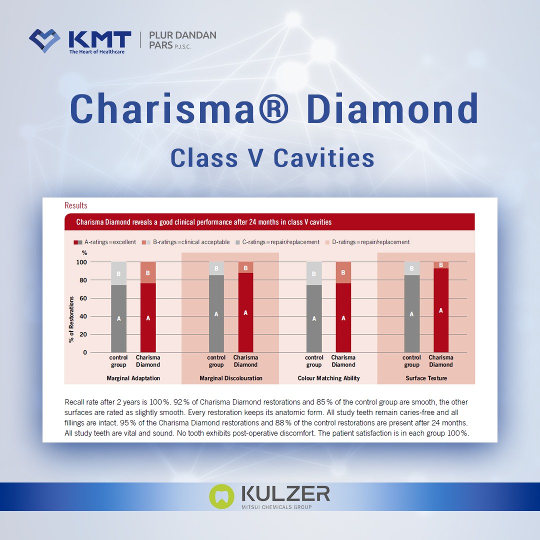 charisma diamond chart 9