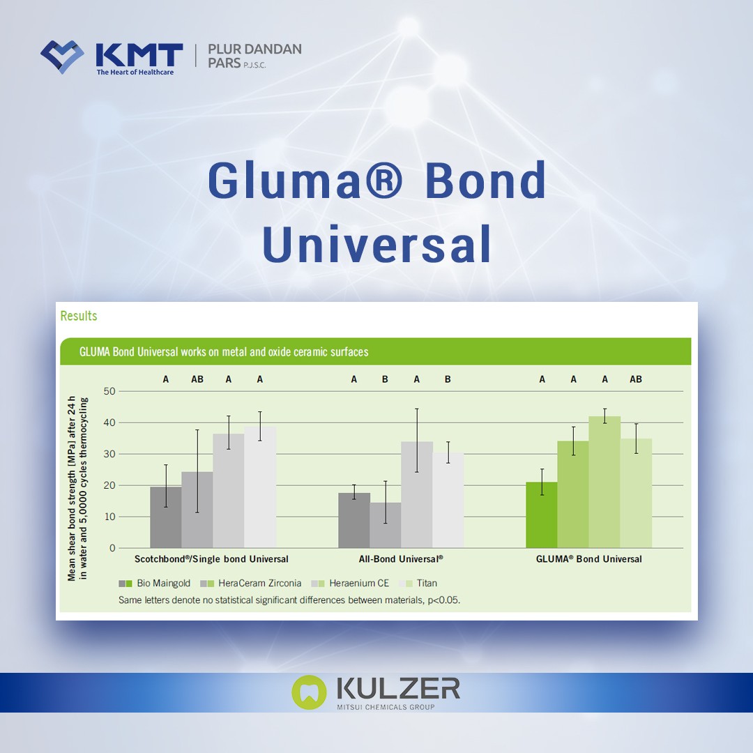 gluma bond universal chart  13