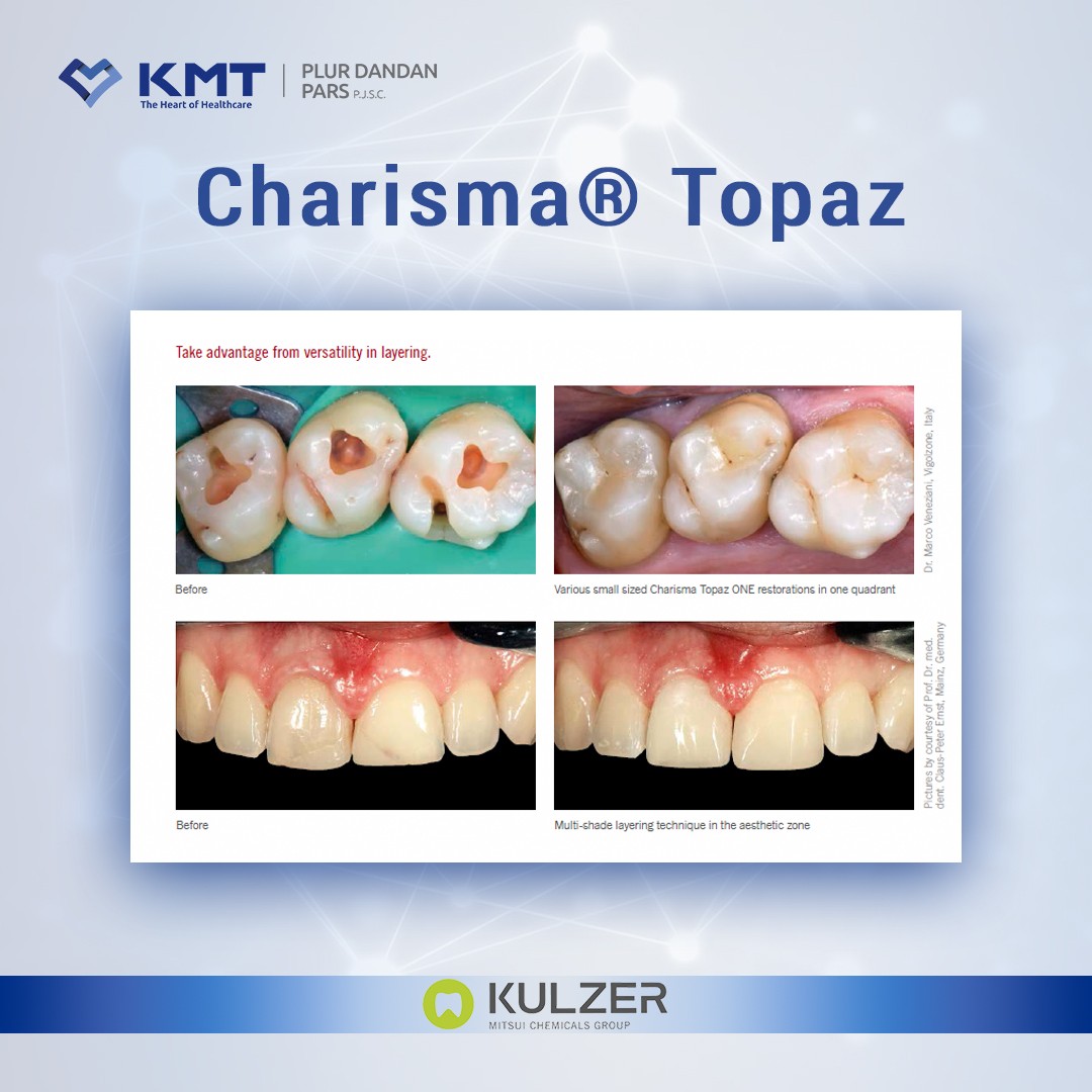 charisma topaz chart 4