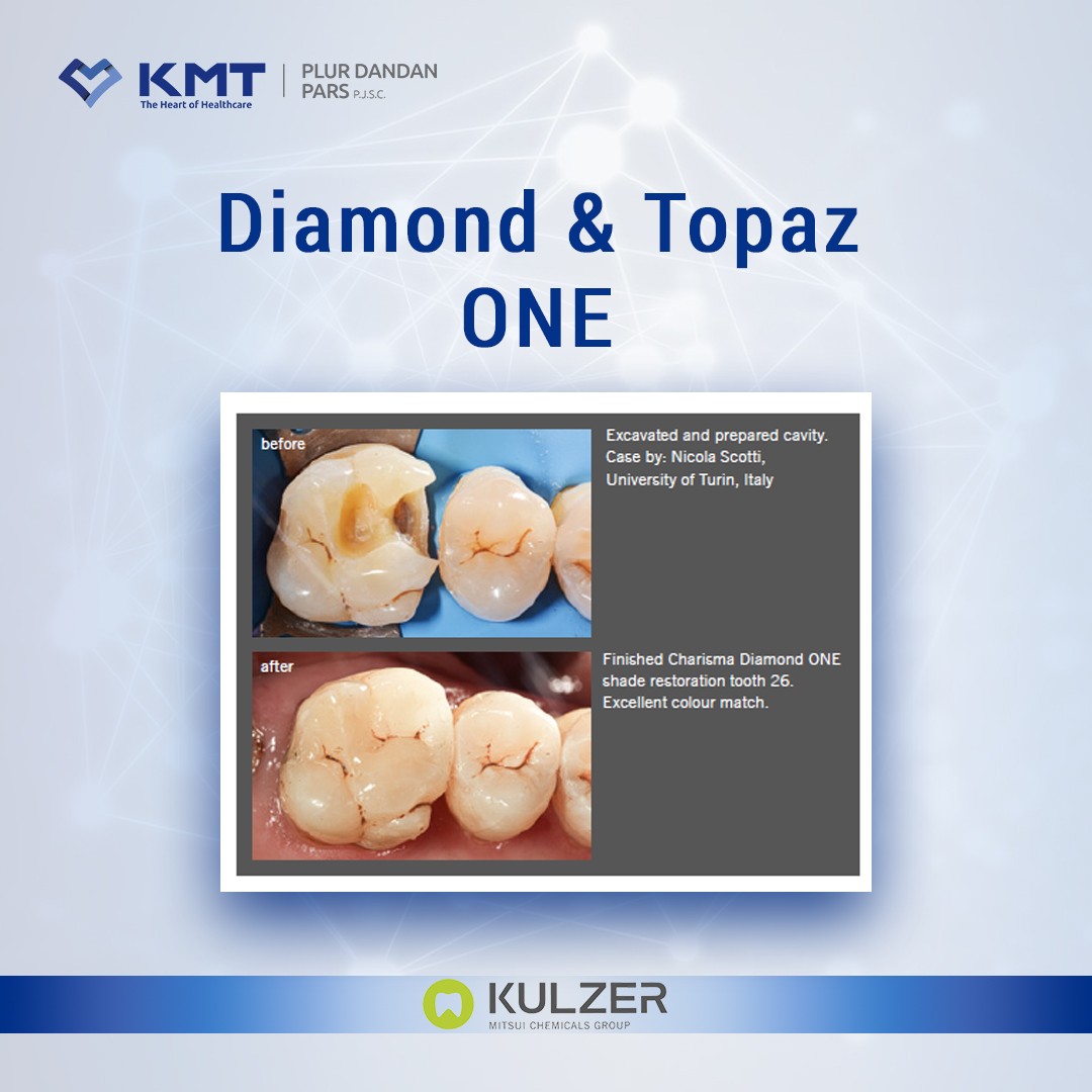 diamond & topaz one chart 1