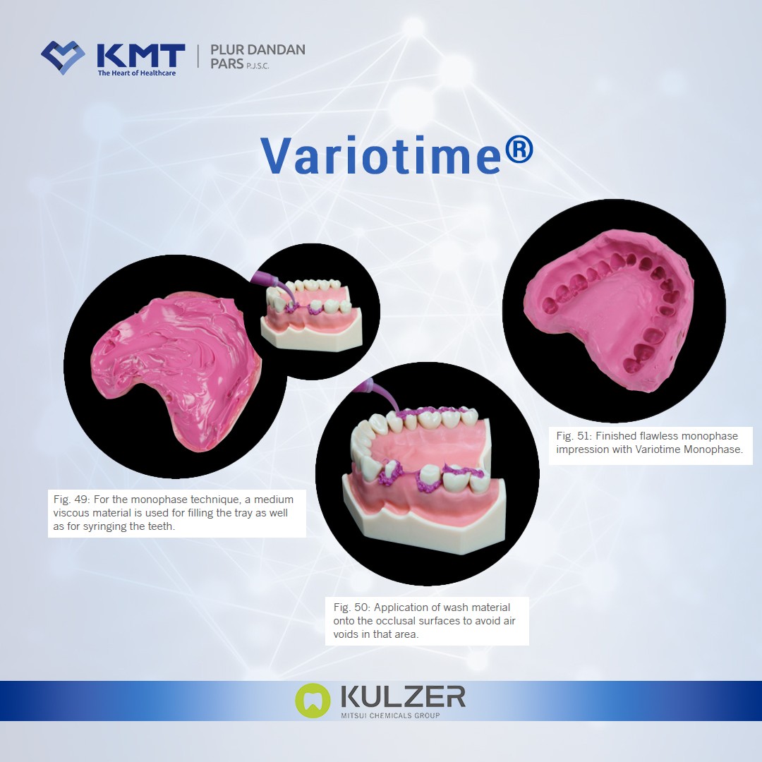 variotime 17