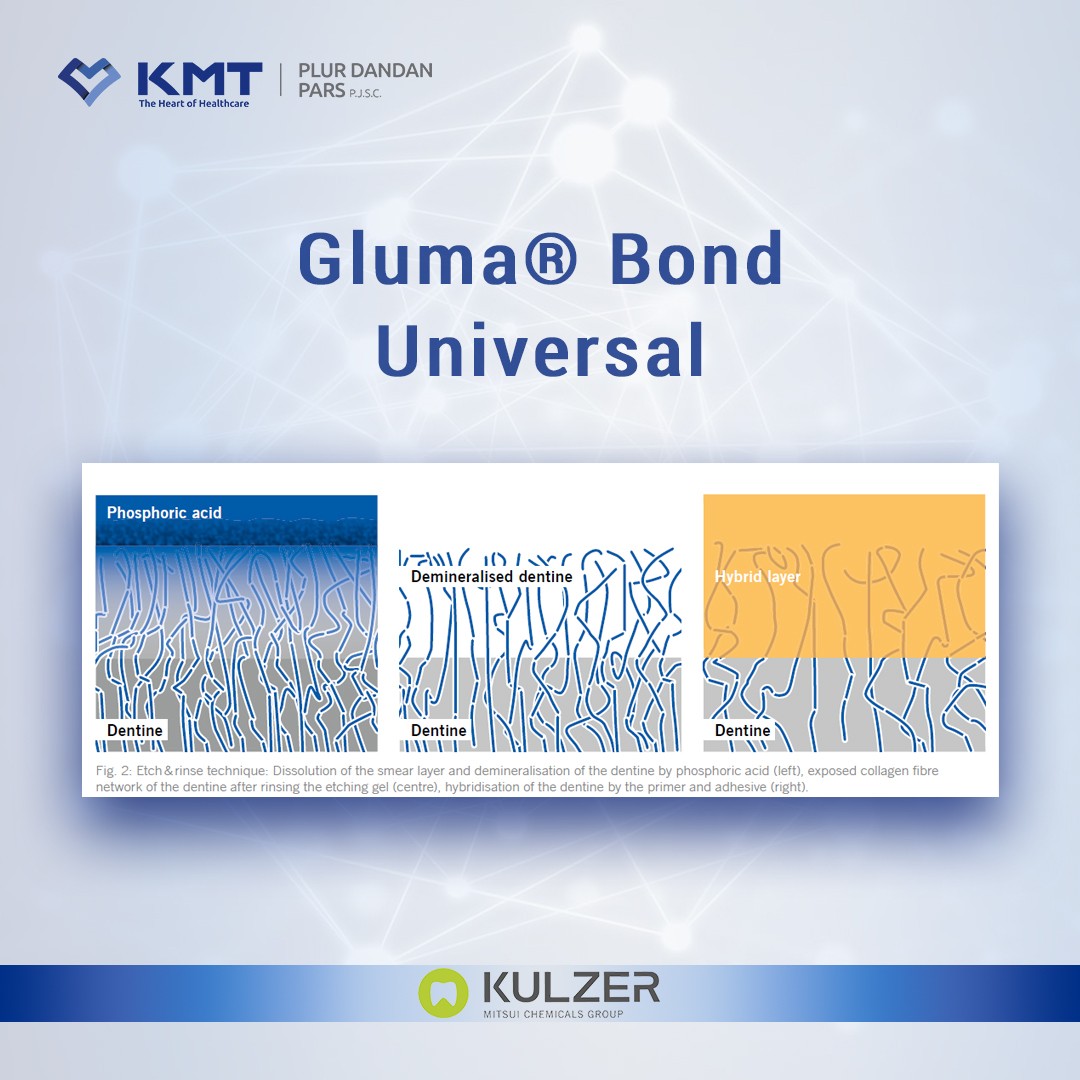 gluma bond universal chart  21