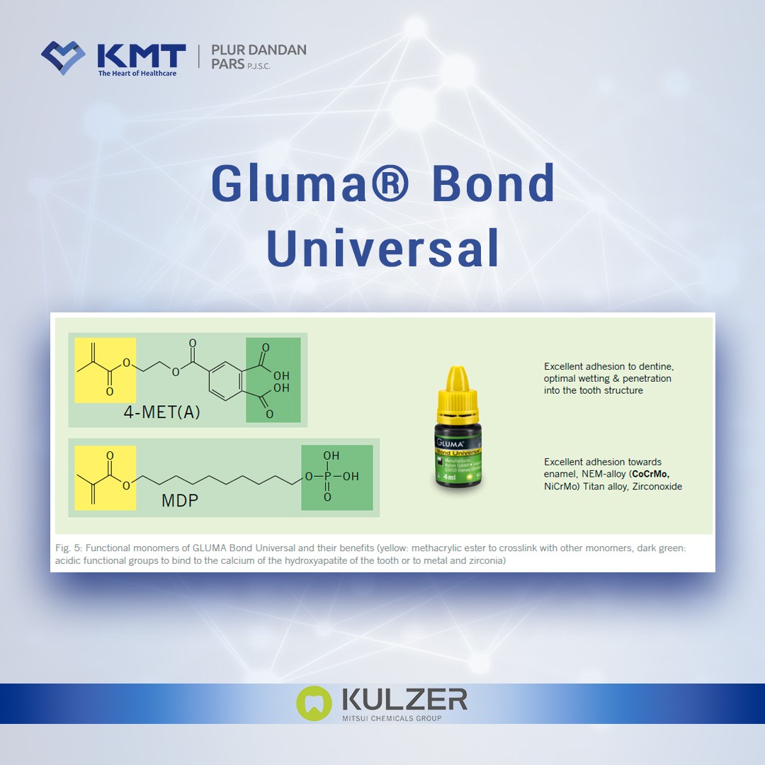 gluma bond universal chart  23