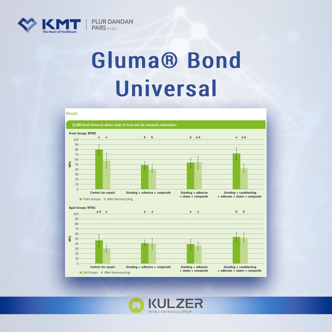 gluma bond universal chart  17