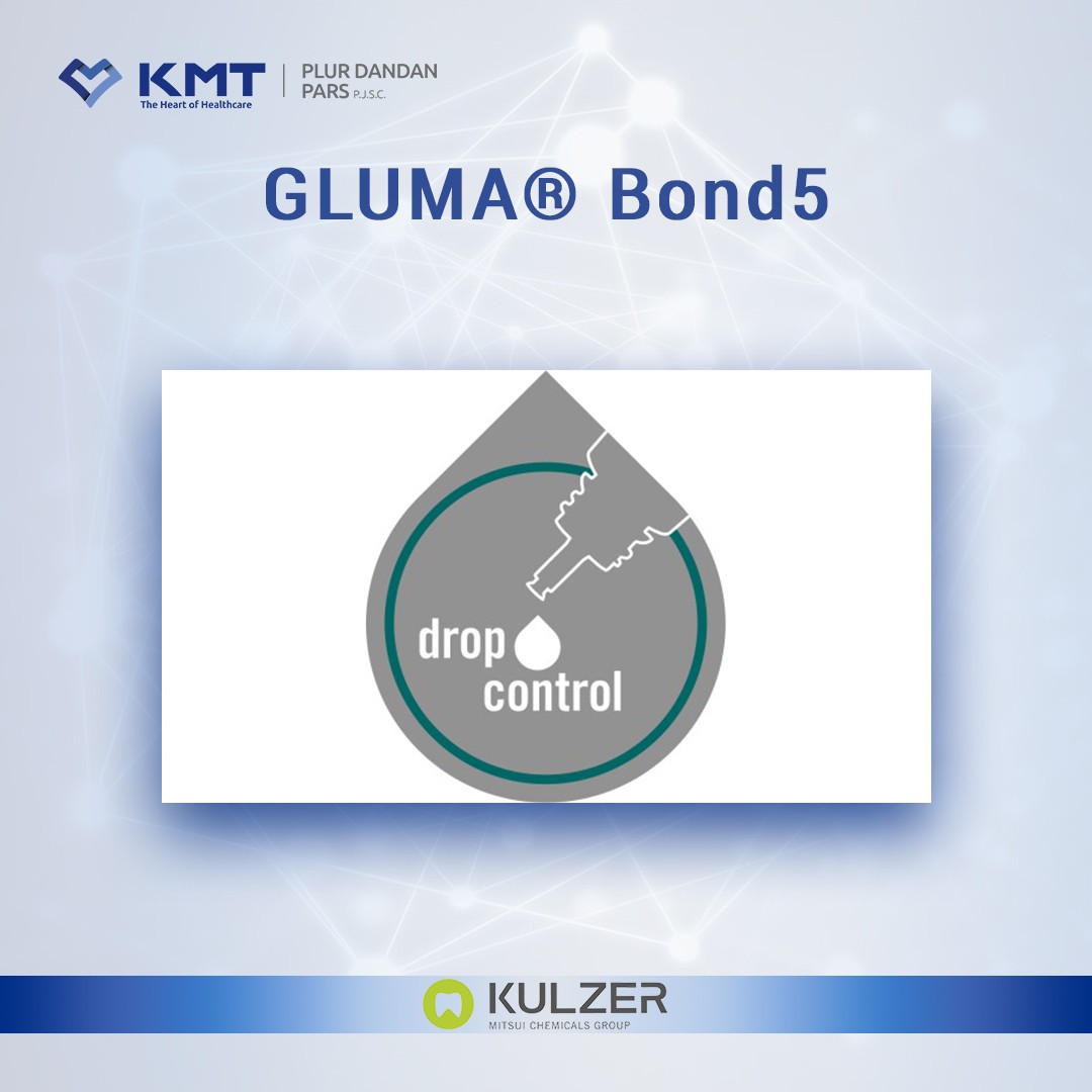 gluma bond5 chart 4