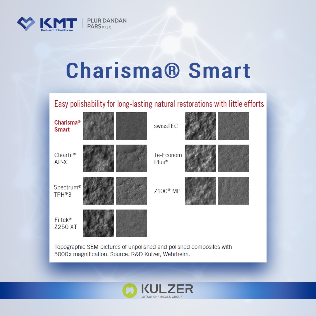 charisma smart chart 4