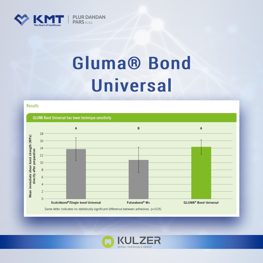 gluma bond universal chart  10
