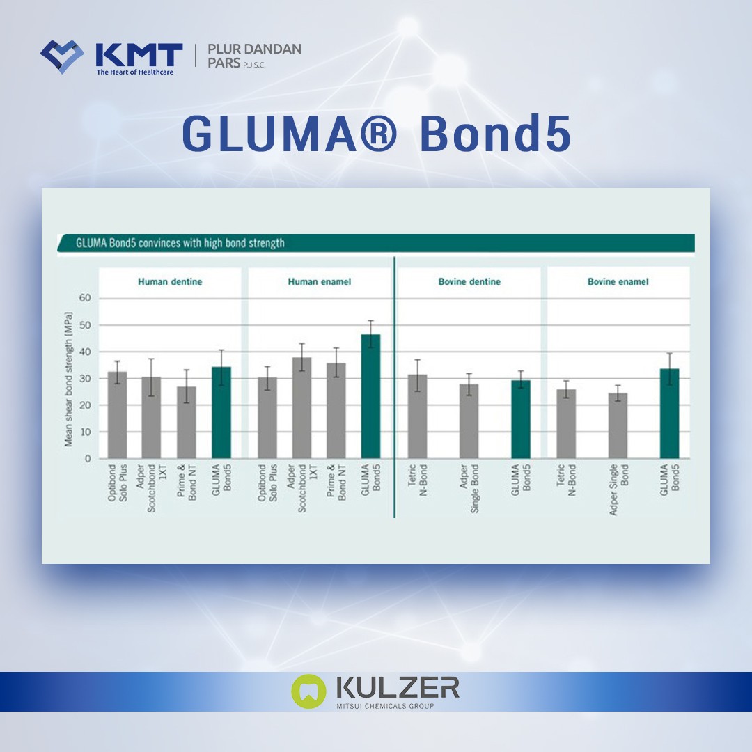 gluma bond5 chart 1