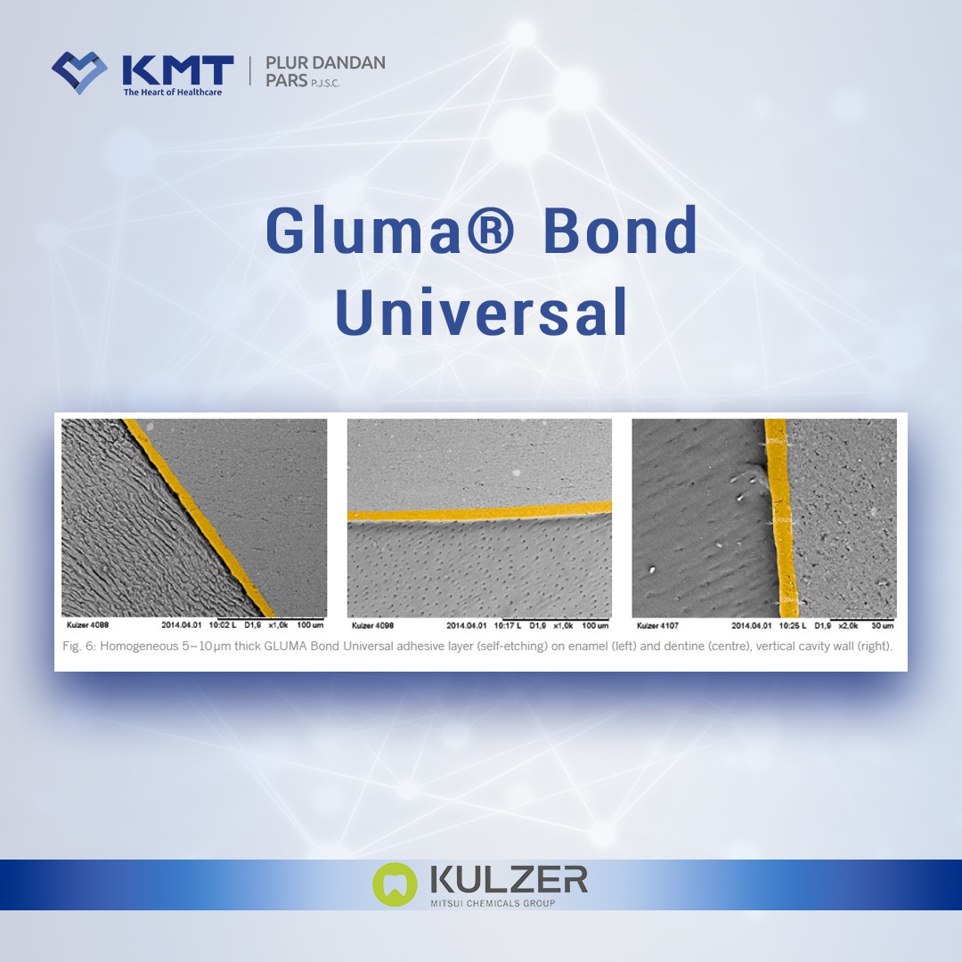 gluma bond universal chart  24