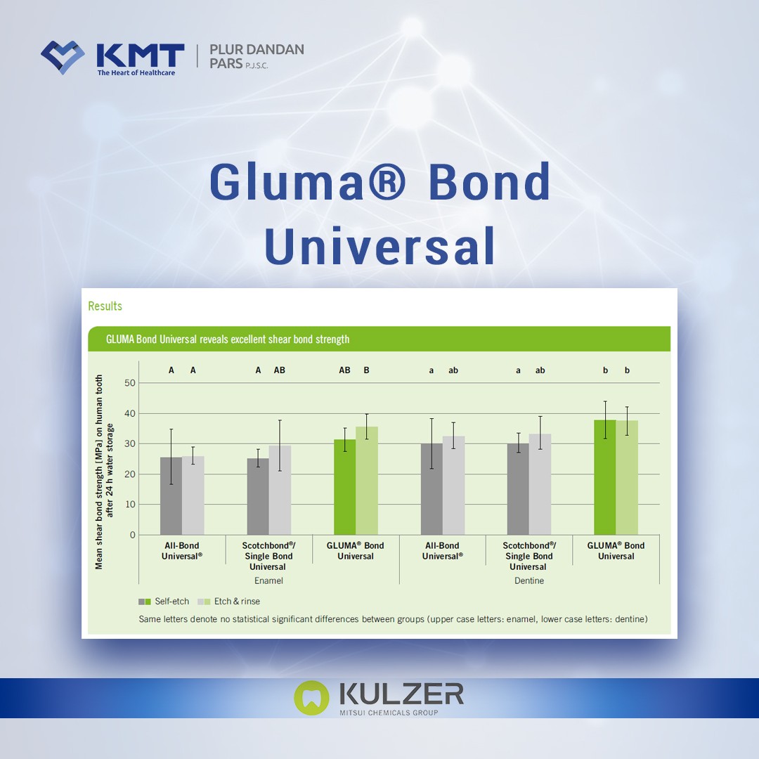 gluma bond universal chart  5