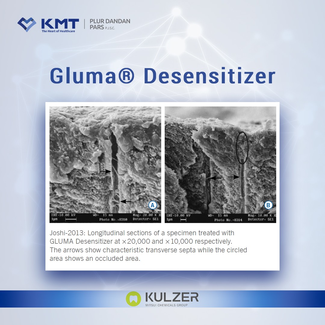 gluma desensitizer chart 2