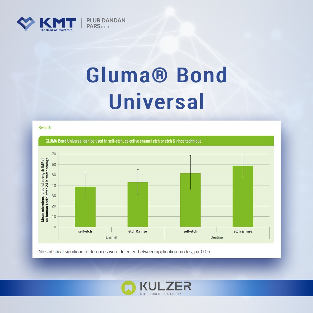 gluma bond universal chart  4